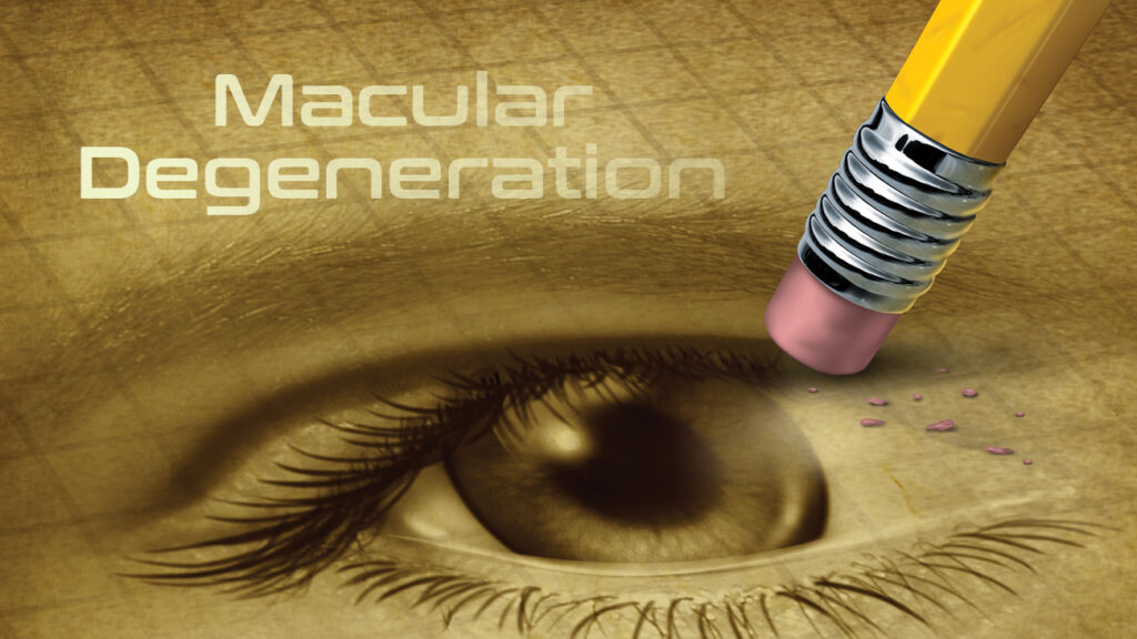 Macular Degeneration